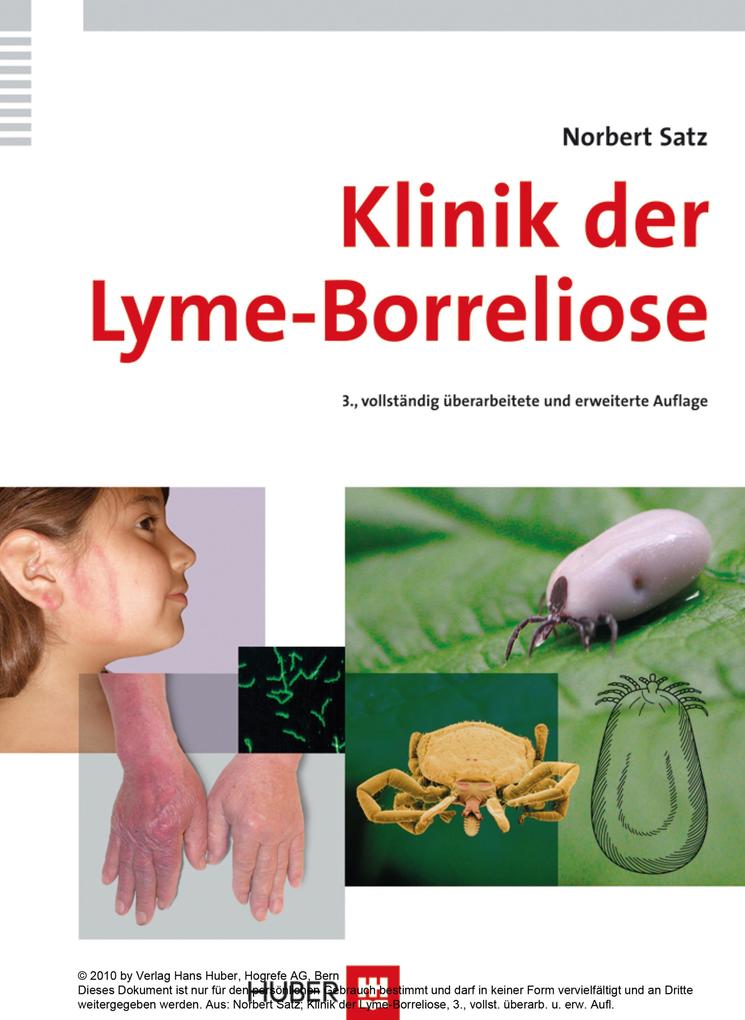 Klinik der Lyme-Borreliose - Norbert Satz