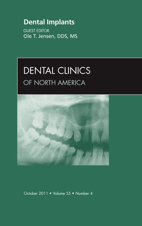 Dental Implants An Issue of Dental Clinics