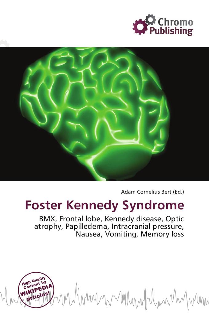 Foster Kennedy Syndrome
