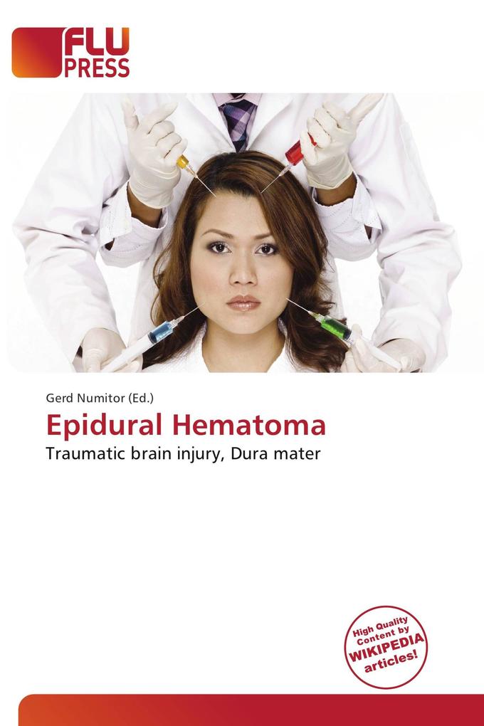 Epidural Hematoma