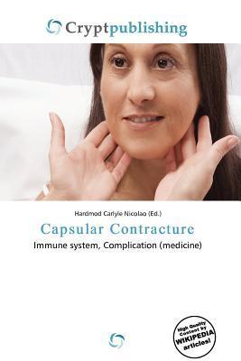 Capsular Contracture