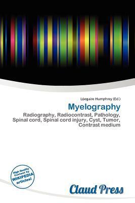 Myelography