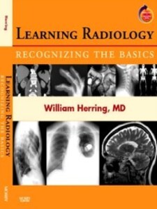 Learning Radiology: Recognizing the Basics als eBook Download von William Herring - William Herring