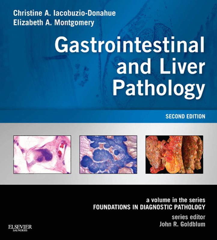 Gastrointestinal and Liver Pathology E-Book