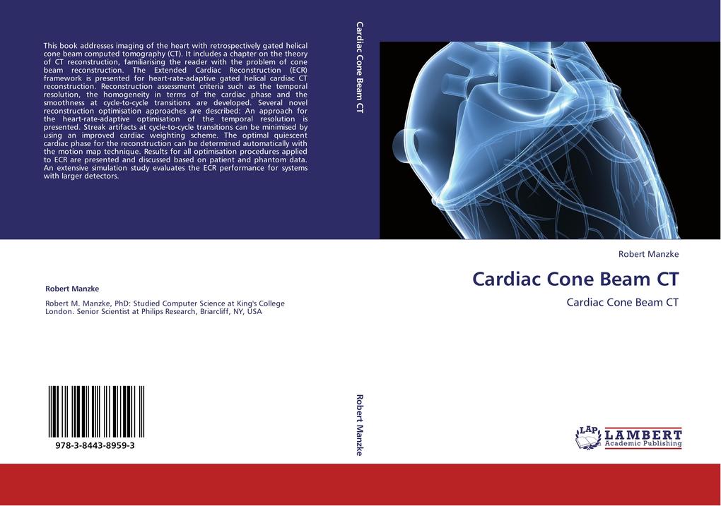 Cardiac Cone Beam CT