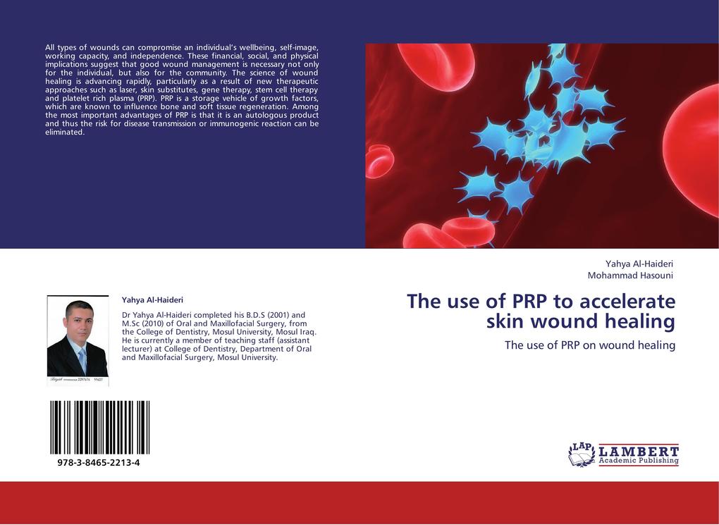 The use of PRP to accelerate skin wound healing