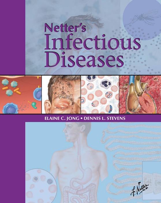 Netter‘s Infectious Diseases E-Book