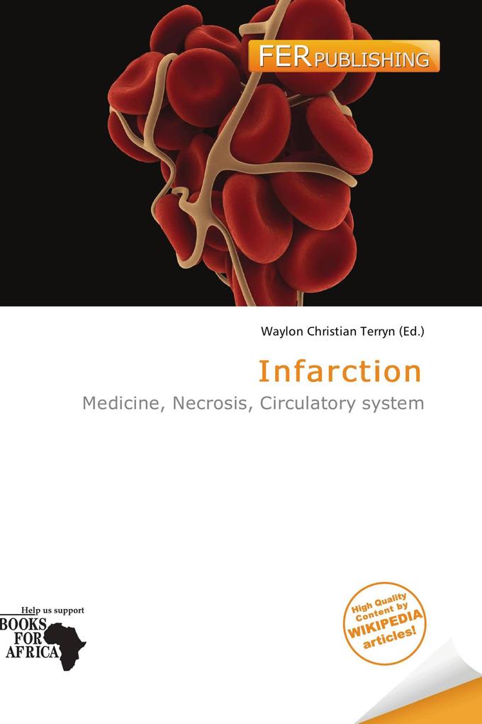 Infarction