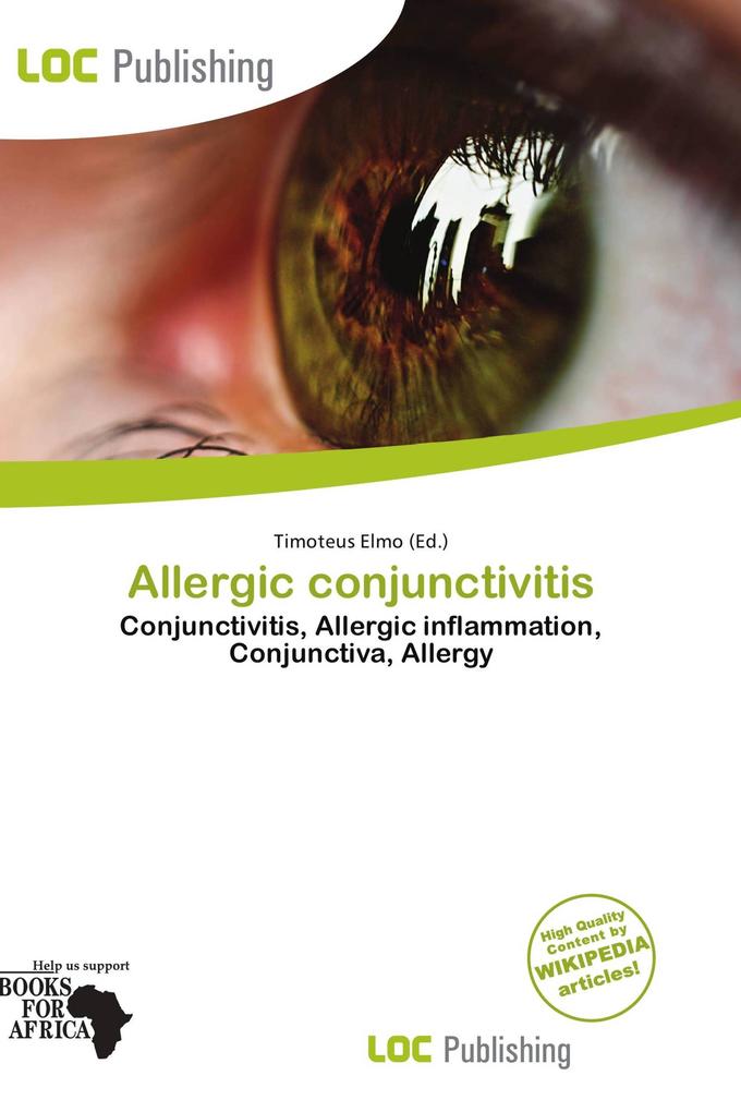 Allergic conjunctivitis