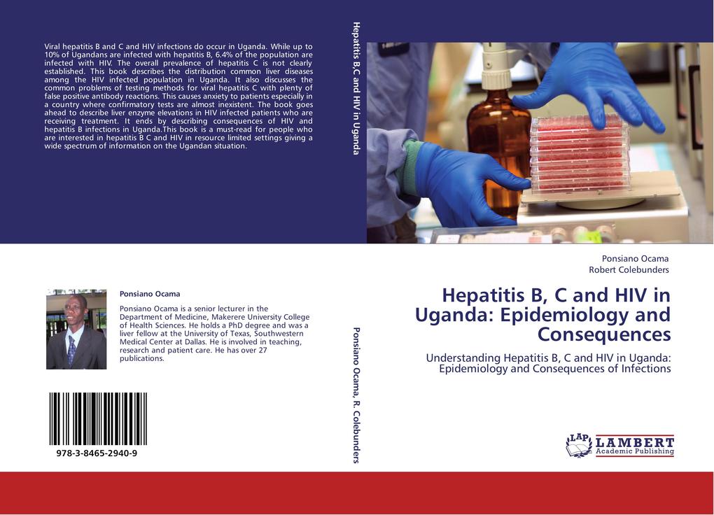 Hepatitis B C and HIV in Uganda: Epidemiology and Consequences
