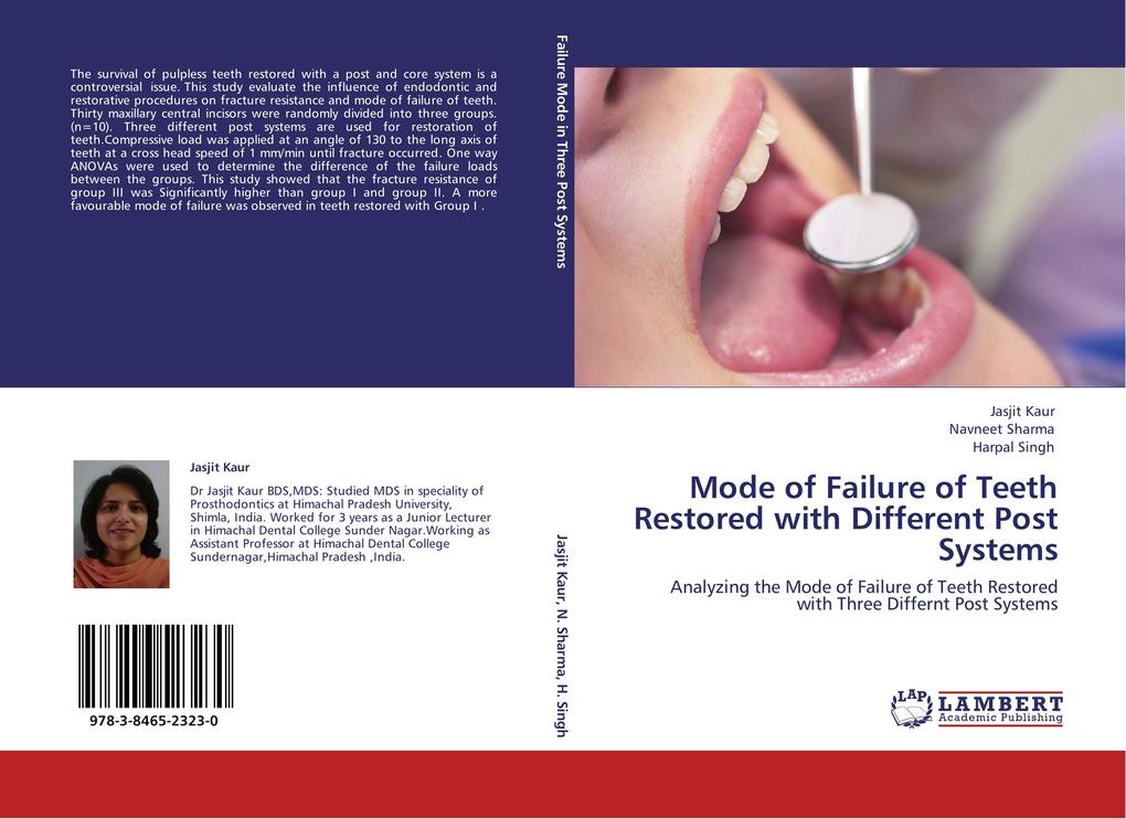 Mode of Failure of Teeth Restored with Different Post Systems