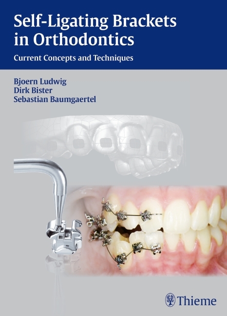 Self-ligating Brackets in Orthodontics - Björn Ludwig/ Dirk Bister/ Sebastian Baumgaertel
