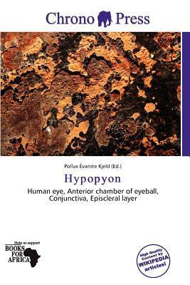 Hypopyon