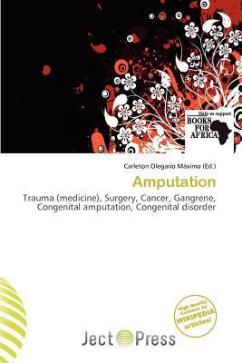Amputation