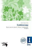 Culdoscopy