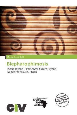 Blepharophimosis
