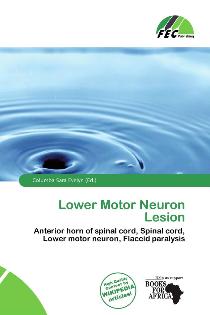 Lower Motor Neuron Lesion