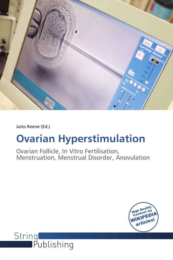 Ovarian Hyperstimulation
