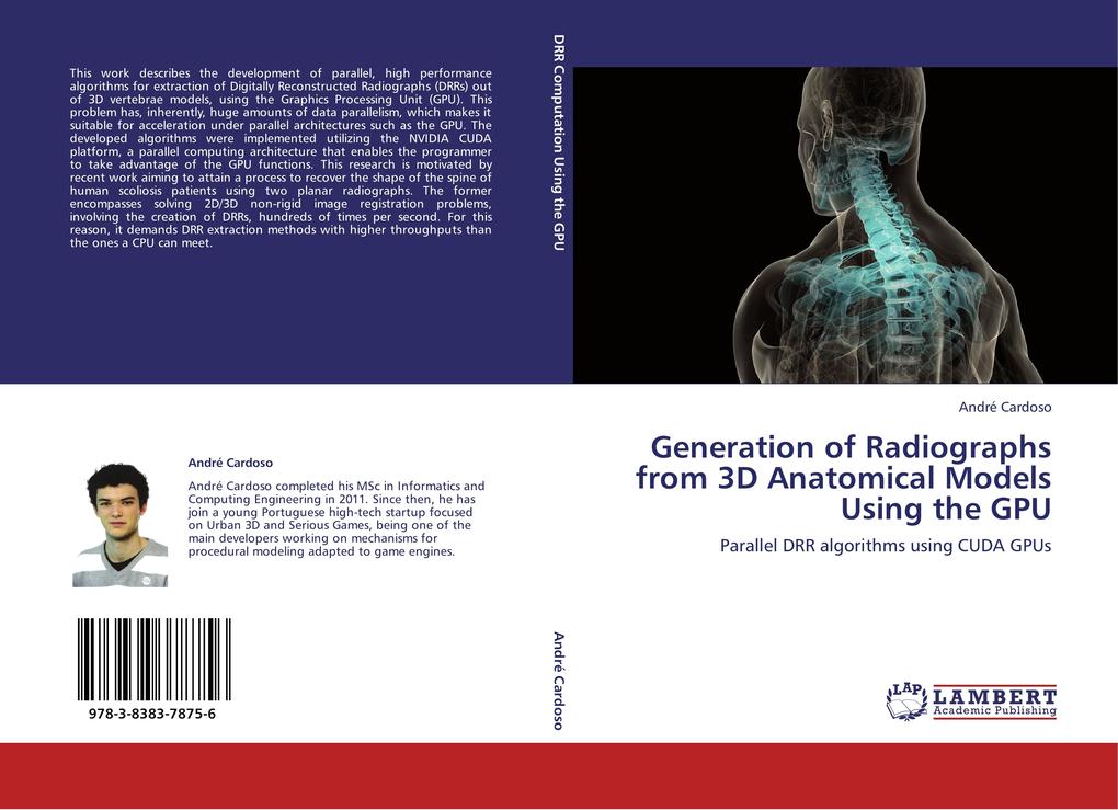 Generation of Radiographs from 3D Anatomical Models Using the GPU