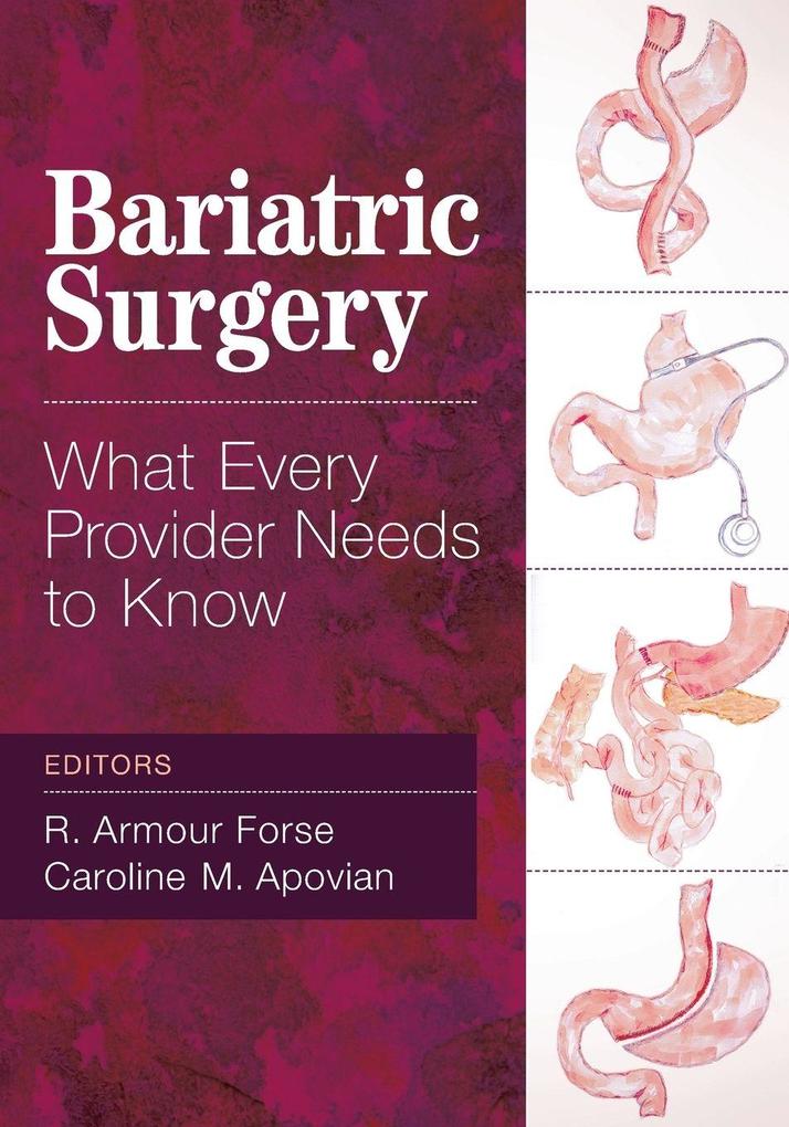 Bariatric Surgery