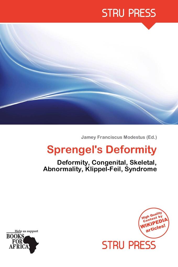 Sprengel's Deformity