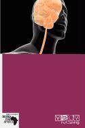 Sensorineural Hearing Loss