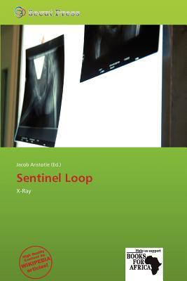 Sentinel Loop