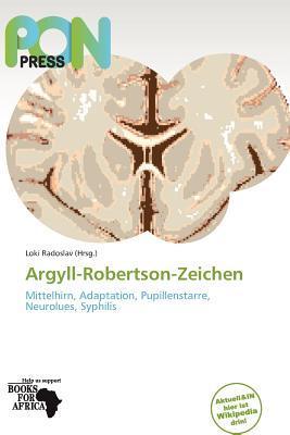 Argyll-Robertson-Zeichen