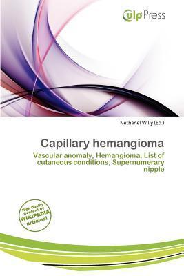 Capillary hemangioma