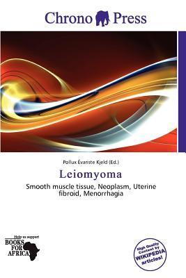 Leiomyoma