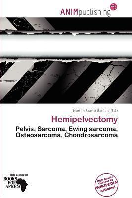 Hemipelvectomy