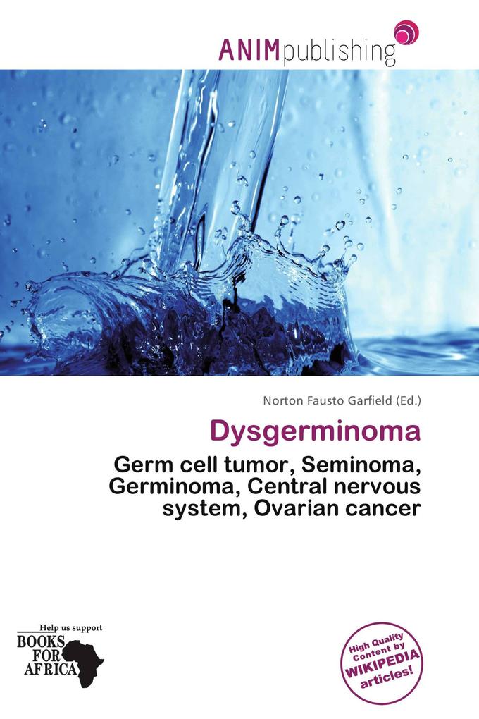 Dysgerminoma