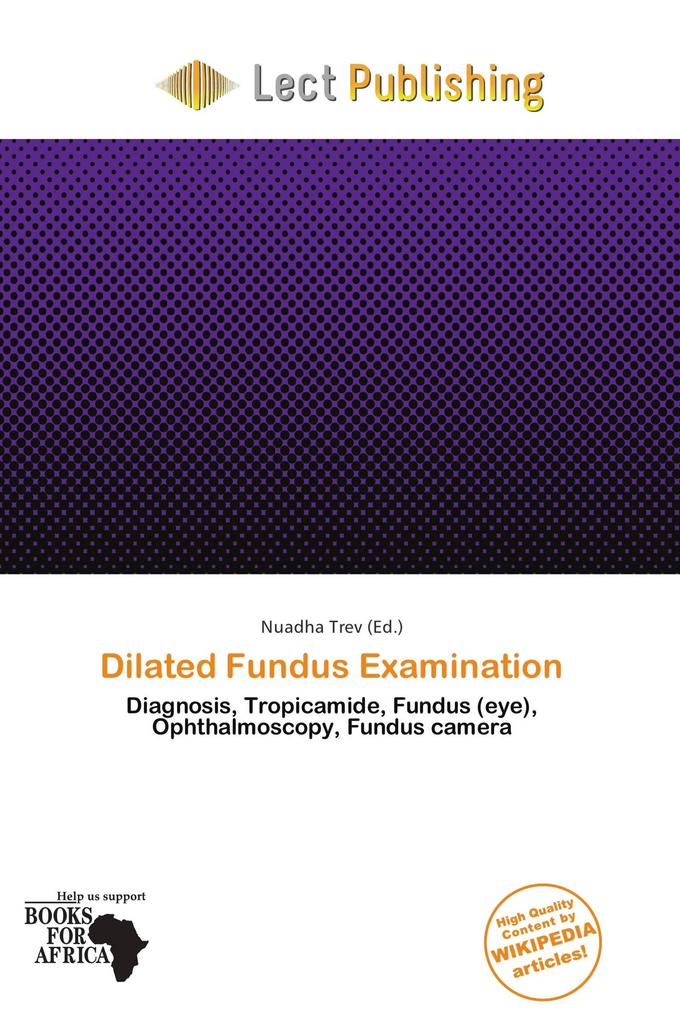 Dilated Fundus Examination