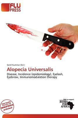 Alopecia Universalis
