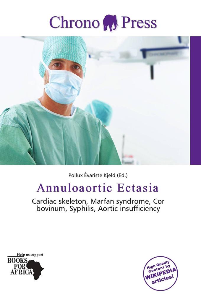 Annuloaortic Ectasia