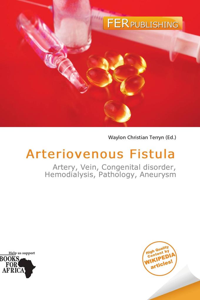 Arteriovenous Fistula