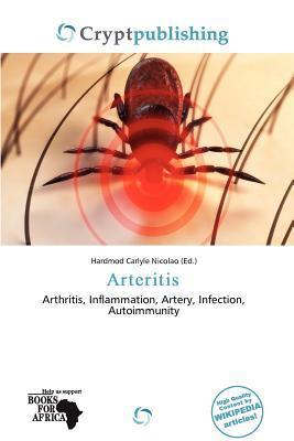 Arteritis