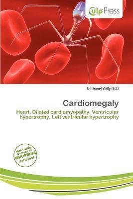 Cardiomegaly