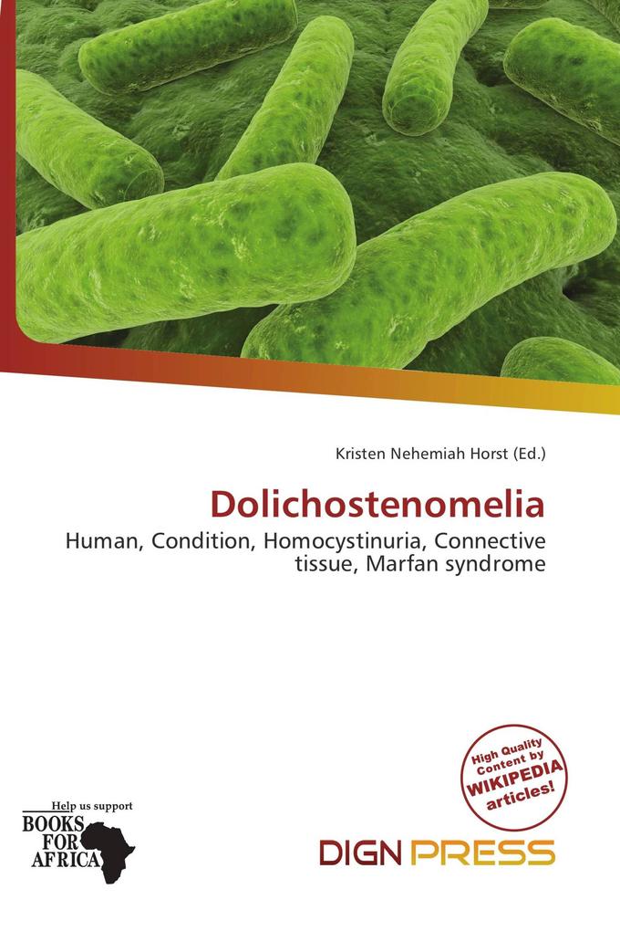 Dolichostenomelia