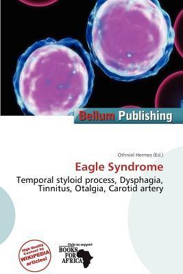 Eagle Syndrome