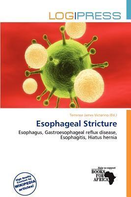 Esophageal Stricture