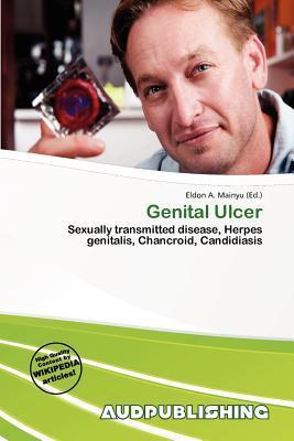 Genital Ulcer