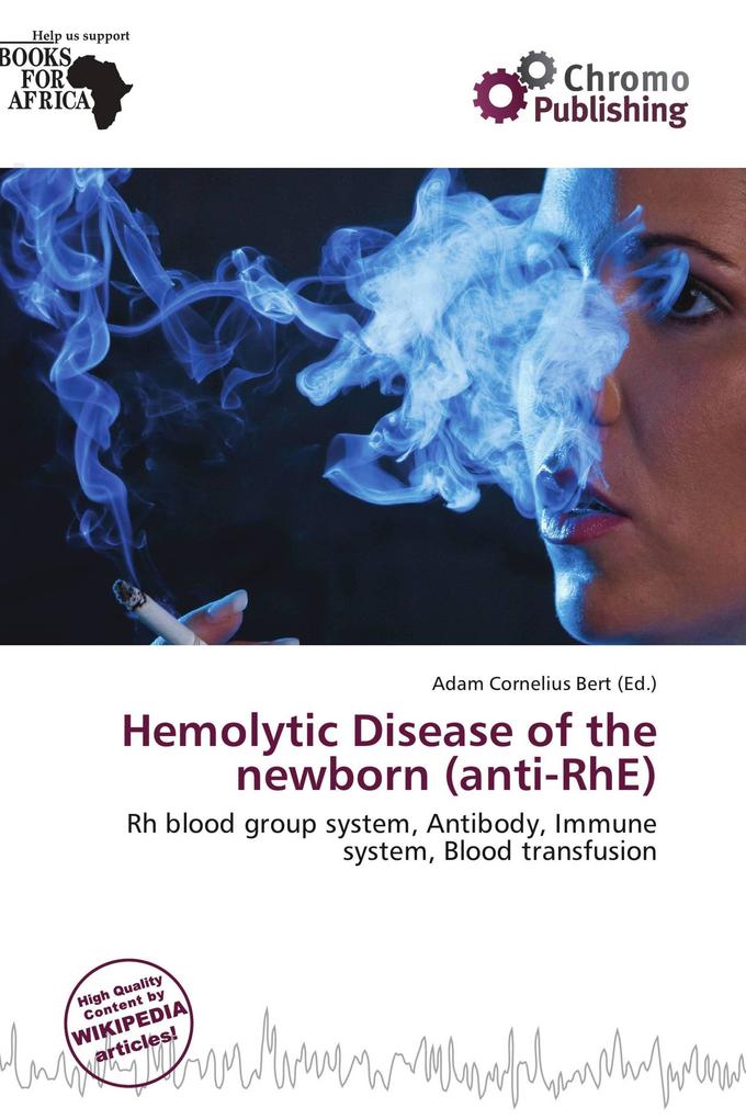 Hemolytic Disease of the newborn (anti-RhE)