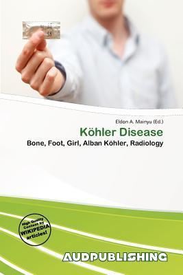 Köhler Disease