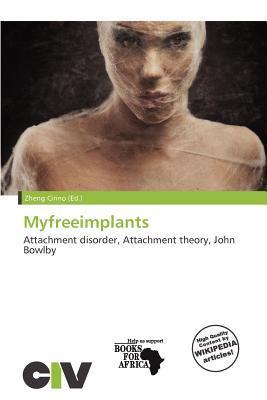 Myfreeimplants