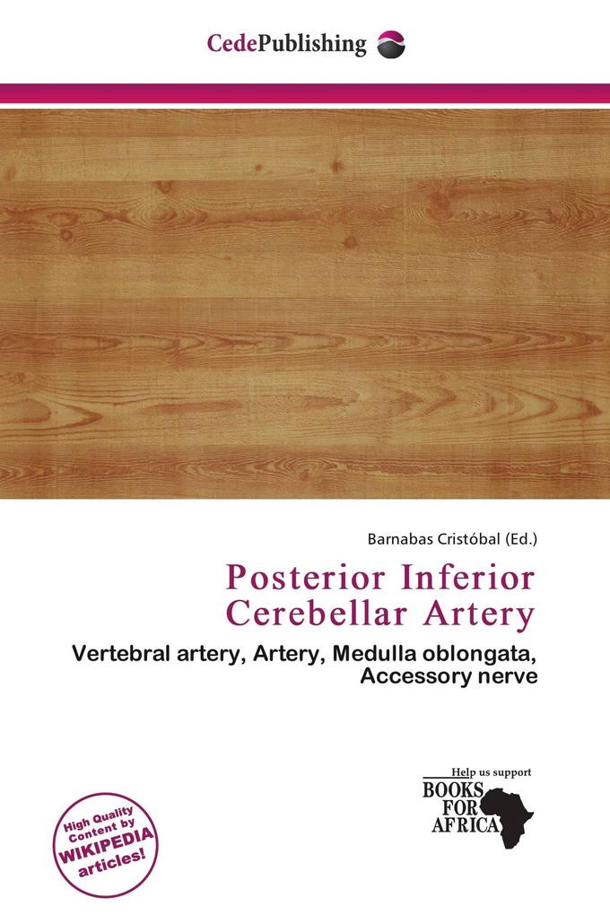 Posterior Inferior Cerebellar Artery