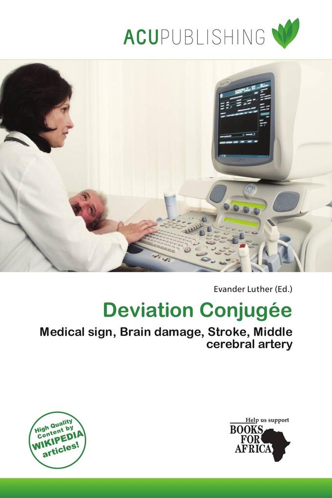 Deviation Conjugée