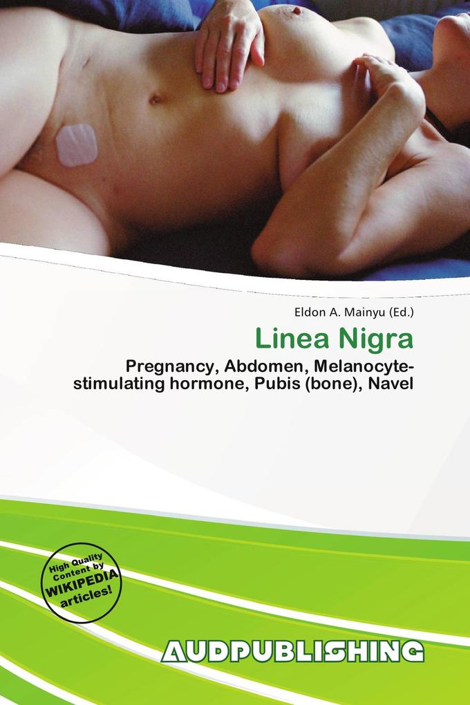 Linea Nigra