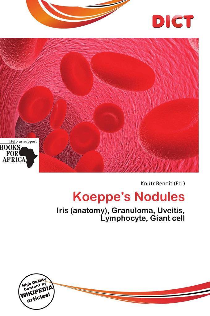 Koeppe's Nodules