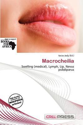 Macrocheilia